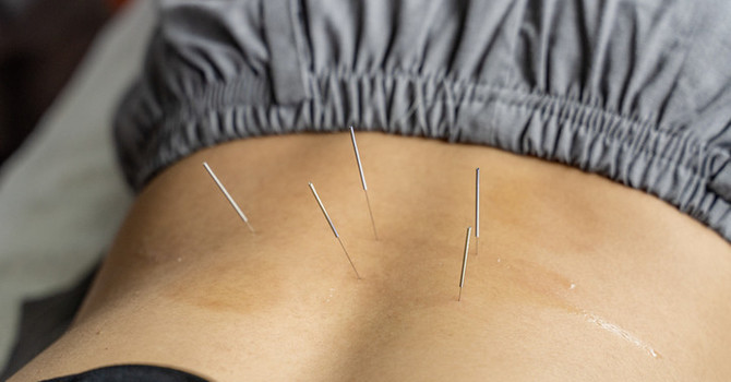 Physiotherapy is available at Cloverdale Chiropractic image