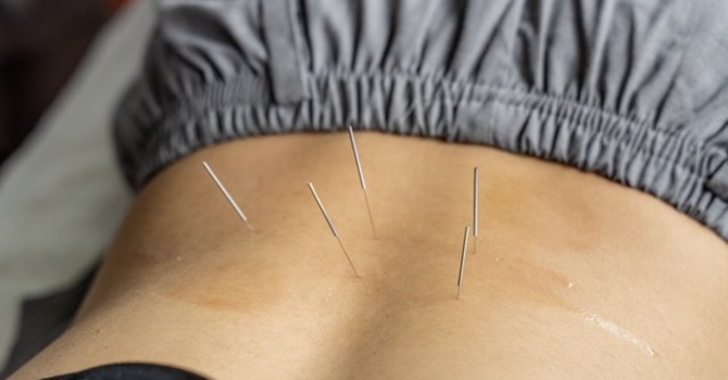 Physiotherapy is now Available! image