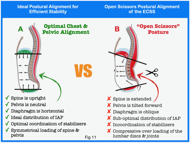 Core Stability Explained: Inside-Out. Part – 3 - DrMorrisGasparin