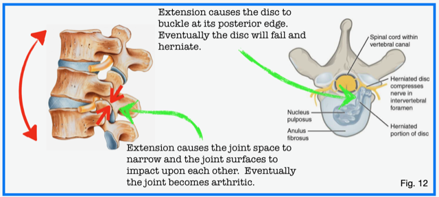 Core Stability Explained: Inside-Out. Part - 1 - DrMorrisGasparin